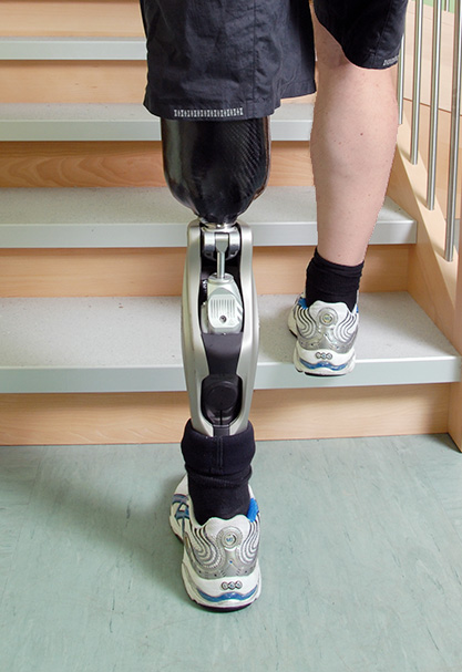 Beinprothese mit Blick von hinten beim Treppenlaufen