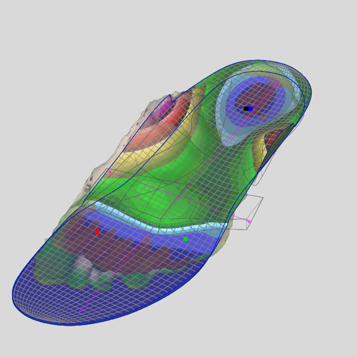 Digitale Fußscananalyse für die richtige Schuheinlage